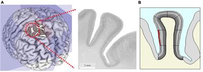 Simulating Local Deformations in the Human Cortex Due to Blood Flow-Induced Changes in Mechanical Tissue Properties: Impact on Functional Magnetic Resonance Imaging